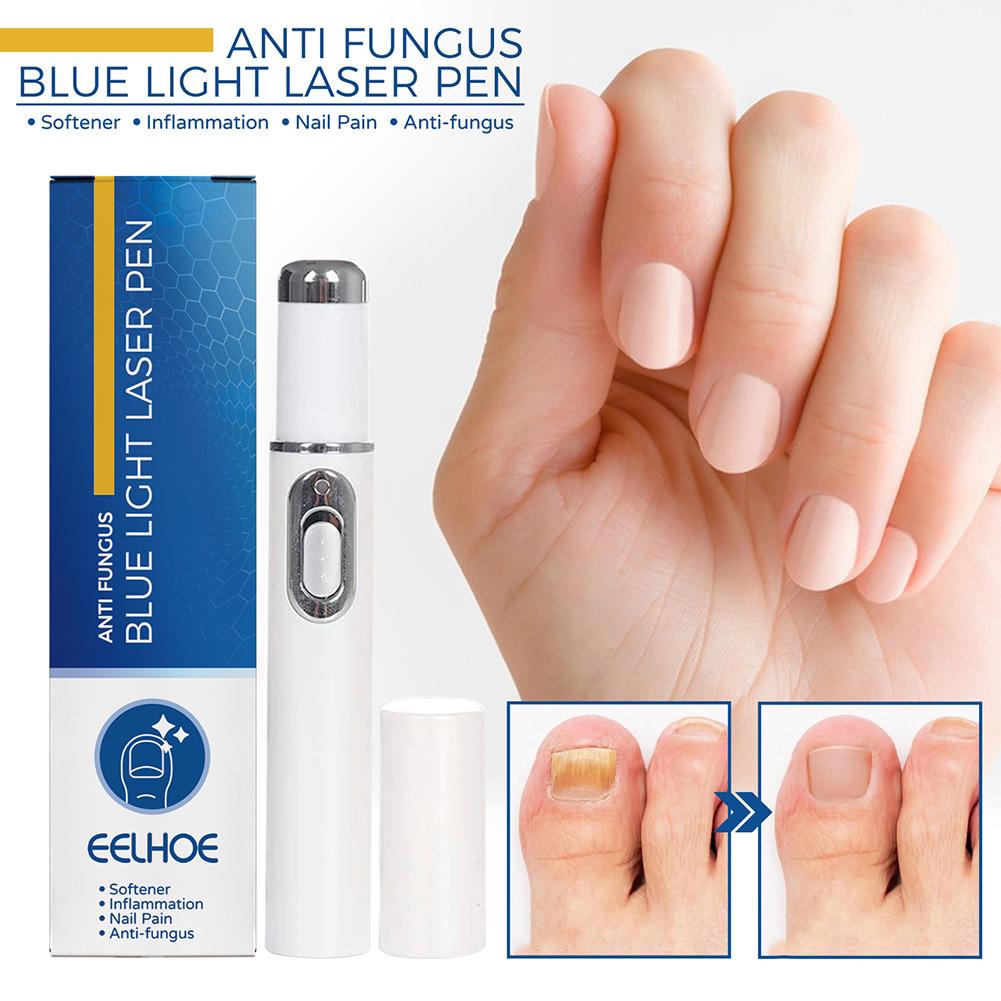 Industrial Laser Removal - Nail Fungus Treatment Pen Anti-fungal Repair