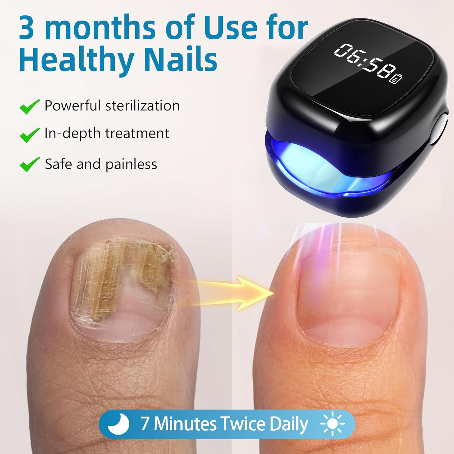 UV Laser Nail Fungus Removal D - Industrial Laser Removal review and price