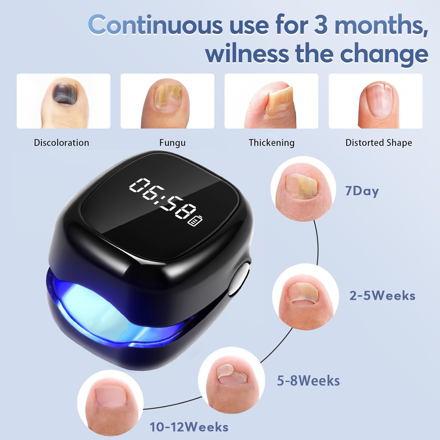 UV Laser Nail Fungus Removal D - Industrial Laser Removal review and price