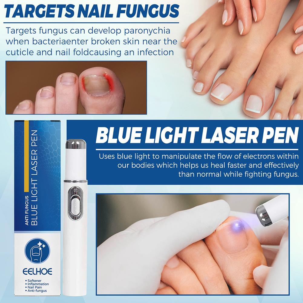 Nail Fungus Treatment Pen Anti - Industrial Laser Removal review and price